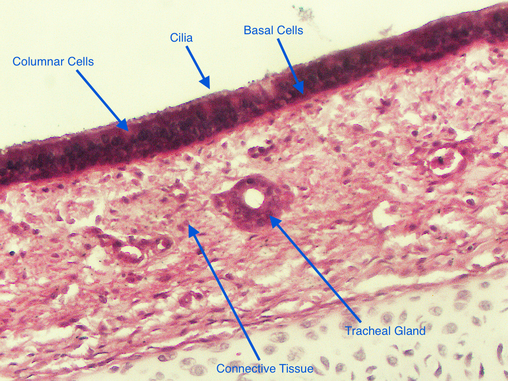 Trachea Slide Labeled